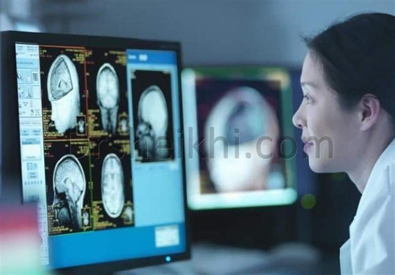 تصویر برداری از مغز برای تشخیص تومور هیپوفیز