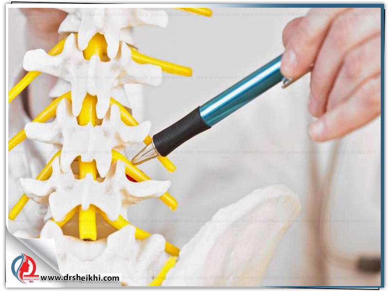 Ways-to-treat-spinal-stenosis