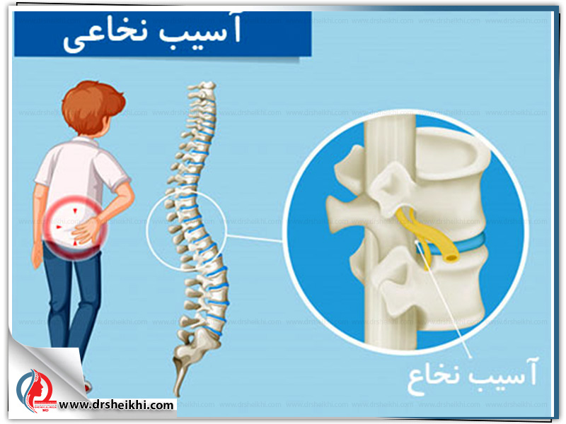 Treatment-of-spinal-stenosis