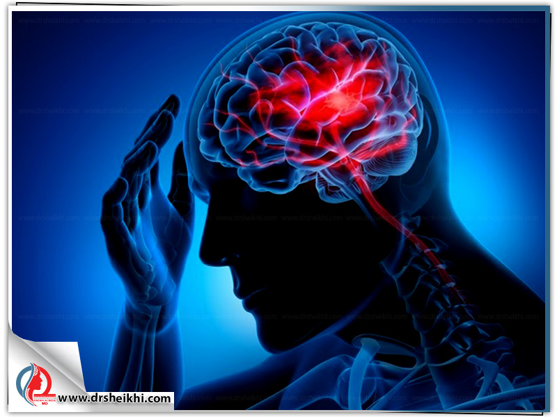 درمغز-چگونه-سبب-سکته-مغزی-میشودAVM