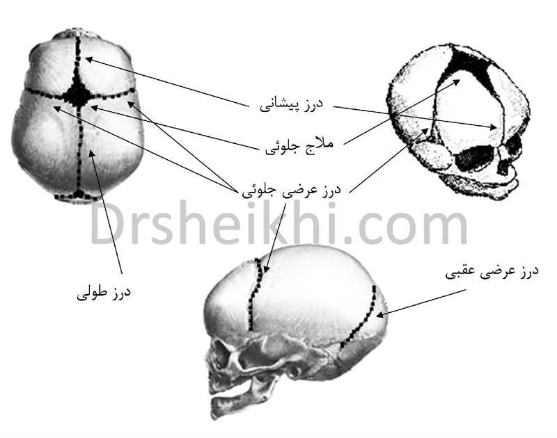 درزهای جمجمه