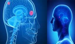 راههای درمان، علائم و تشخیص تومور در مغز