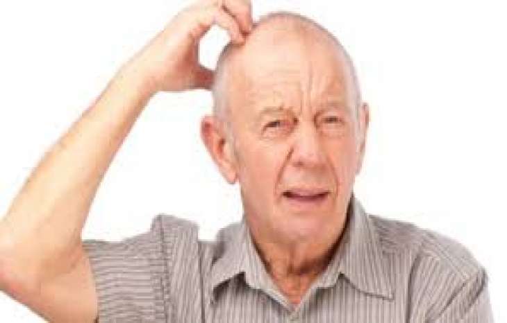 آگنوزیا اختلال عصبی نادر و عجیب