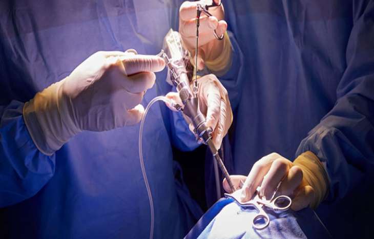 جراحی ونتریکولوستومی اندوسکوپیک بطن سوم