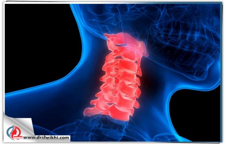  دیسک گردن و راههای تشخیص و درمان آن